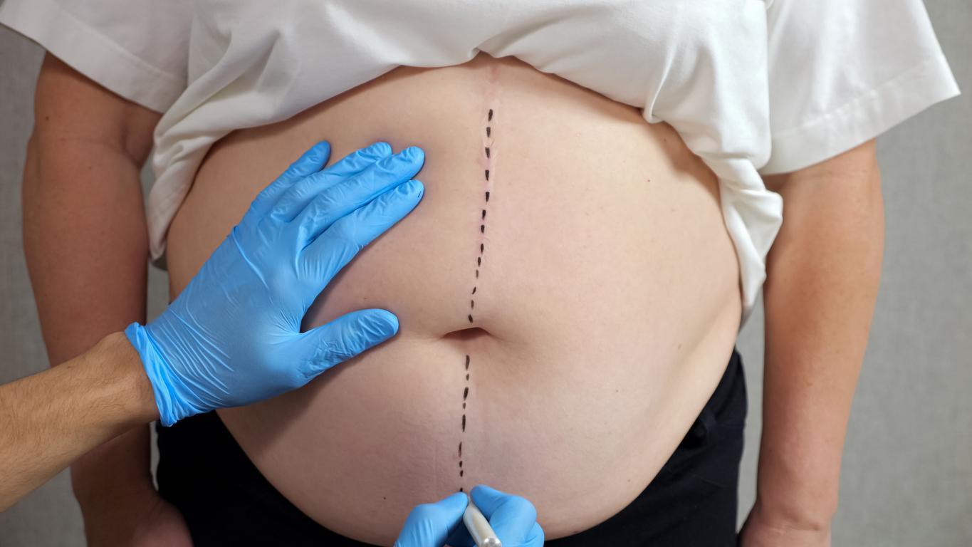 post-chirurgie post-chirurgie